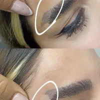 تخفیفات پاککردن تتو صورت وبدن|خدمات زیبایی و سلامت|کرمانشاه, |دیوار