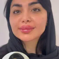 ژل بوتاکس|خدمات آرایشگری و زیبایی|اهواز, پادادشهر|دیوار