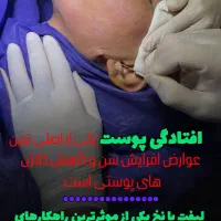 مدل تزریق فیلر،زاویه سازی ،لیفت با نخ، فیلر باسن|خدمات آرایشگری و زیبایی|تهران, قیطریه|دیوار