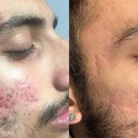 زیبایی پوست و مو لاغری موضعی