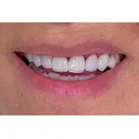 منشی مطب دندانپزشکی زیبایی