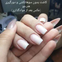 آموزش تخصصی کاشت ژل و رفع اشکال و آپدیت