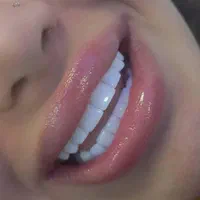 کامپوزیت زیبایی دندان پزشکی|خدمات آرایشگری و زیبایی|یاسوج, |دیوار