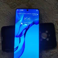 آنر x9|موبایل|تبریز, |دیوار