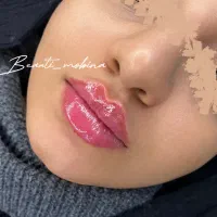 خدمات زیبایی زیرنظرپزشک خانم ها و اقایان