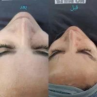 آموزشگاه مراقبت و زیبایی شاپرک