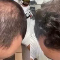 اگه کچلی سلام
