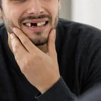 ایمپلنت از دم قسط بدون پیش پرداخت