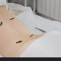 آموزش و انجام تزریقات حجامت زالودرمانی|خدمات آرایشگری و زیبایی|دورود, |دیوار