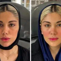 آموزش فیلر ژل بوتاکس نخ لیفت لیزر مو فشیال حجامت|خدمات آموزشی|اصفهان, هزارجریب|دیوار