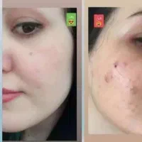 کرم وی ای پی اصل صدرصد تضمینی سفیدکننده قوی|حراج|یاسوج, |دیوار
