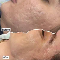 لک صورت وتکنیک پوست کره ای تخفیف ویژه اخرسال