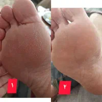 تونیک نانو نقره از محصولات سلامتی و مراقبت  اریا|آرایشی، بهداشتی، درمانی|قرچک, مهدیه|دیوار