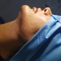 ساکشن غبغب،بلفاروپلاستی،جراحی توده،لیپوساکشن|خدمات آرایشگری و زیبایی|اصفهان, شهریار|دیوار