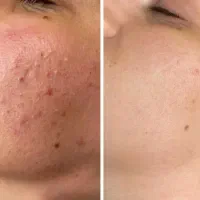 بیوممتیک(معجزه پوست)از نمایندگی اصلی