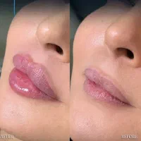 مرکز تخصصی فرم دهی و‌لیفت بینی و صورت با نخ و‌ژل|خدمات آرایشگری و زیبایی|مشهد, احمدآباد|دیوار