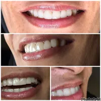 لبخندتو بساز،قسطی پرداخت کن