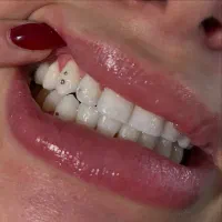 خدمات دندان پزشکی و دندان سازی