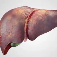 کبدت رو مثل آینه شفاف کن