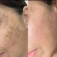 شوینده صورت دست پا تضمینی صد در صد جواب میده