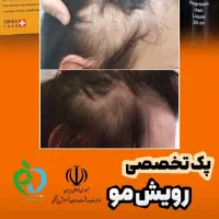 درمان مشکلات مو