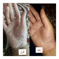 استقلال مالی ودرمان باطب سنتی آنلاین ویژه بانوان|استخدام بازاریابی و فروش|کرج, اکبرآباد|دیوار