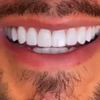 دندانپزشکی|آرایشی، بهداشتی، درمانی|ارومیه, |دیوار