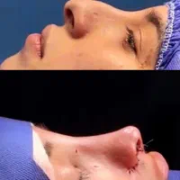 جراحی زیبایی با بهترین متخصص زیبایی در بندر عباس