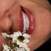 کامپوزیت دندان روش لیرینگ با ضمانت