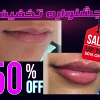 کلینیک تزریق ژل لب روسی فیلر چانه لیزر لیفت صورت|خدمات آرایشگری و زیبایی|تهران, صادقیه|دیوار