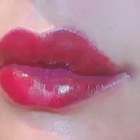 ریموو تضمینی