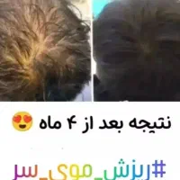 پک ریزش و رویش مجدد مو|آرایشی، بهداشتی، درمانی|تهران, فلاح|دیوار