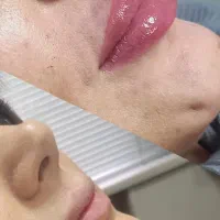 تخفیف تکرارنشدنی|خدمات آرایشگری و زیبایی|رشت, چله خانه|دیوار