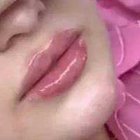 ترزیق ژل و بوتاکس،تخصصی و تضمینی|خدمات آرایشگری و زیبایی|نورآباد, |دیوار