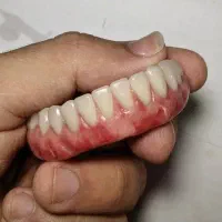 ساخت دندان متحرک|خدمات آرایشگری و زیبایی|شوش, |دیوار