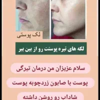 پوست صاف و شفاف