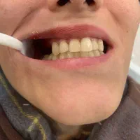 دندان مصنوعی (پروتز)|خدمات آرایشگری و زیبایی|گالیکش, |دیوار