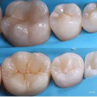 جشنواره خدمات دندانپزشکی