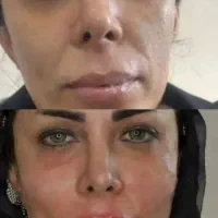 جوان سازی و زیباسازی پوست