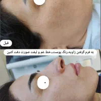 خدمات زیبایی پوست و مو در مطب دکتر شریفی|خدمات آرایشگری و زیبایی|فولادشهر, B5|دیوار