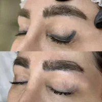 پاک کردن تتوهای صورت وبدن|خدمات آرایشگری و زیبایی|کرمان, |دیوار