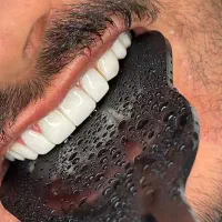 کامپوزیت/لمینیت/عصب کشی/روکش طلا|خدمات آرایشگری و زیبایی|تهران, دردشت|دیوار