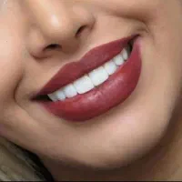 خدمات کامپوزیت،روکش،دندان مصنوعی|خدمات آرایشگری و زیبایی|چهاردانگه (تهران), |دیوار