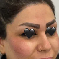 ژل،بوتاکس،مزوتراپی مو صورت،آنزیم،فیلرلب|خدمات آرایشگری و زیبایی|کرج, ساماندهی|دیوار