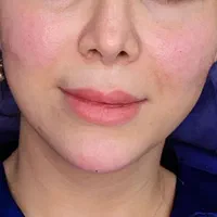 کلنیک زیبایی  لیزر تتو بدن، تزریق ژل و بوتاکس و...|خدمات آرایشگری و زیبایی|اسلام‌شهر, شهرک واوان|دیوار