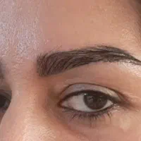 کاشت ابرو سوپر نچرال