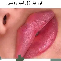 جذب مدل زیبایی