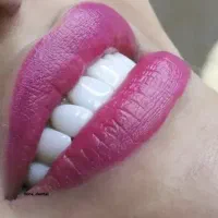 عصب کشی کامپوزیت|خدمات آرایشگری و زیبایی|بروجرد, |دیوار