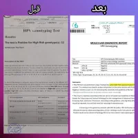 پوستت صورت زیبا کن|آرایشی، بهداشتی، درمانی|خرمآباد, |دیوار