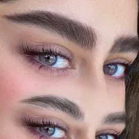 میکروبلیدینگ شیدینگ لب فیبروزهاشوراقتصادی